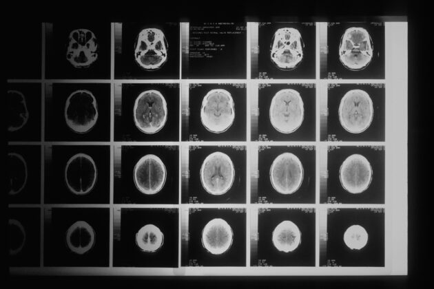 Microsoft revoluciona el diagnóstico médico con IA: más precisa y más económica que los doctores humanos